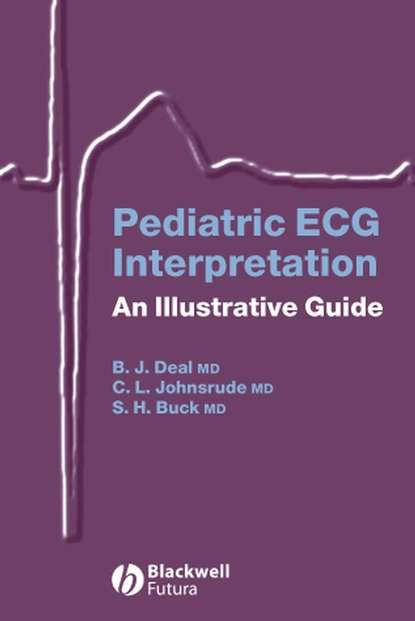 Скачать книгу Pediatric ECG Interpretation