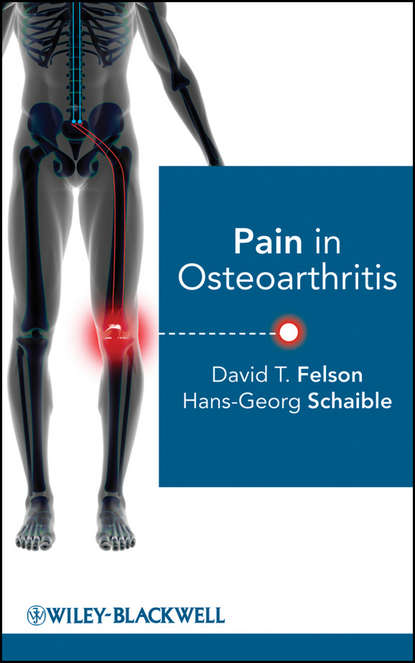 Скачать книгу Pain in Osteoarthritis