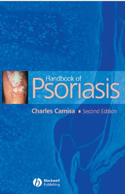 Скачать книгу Handbook of Psoriasis