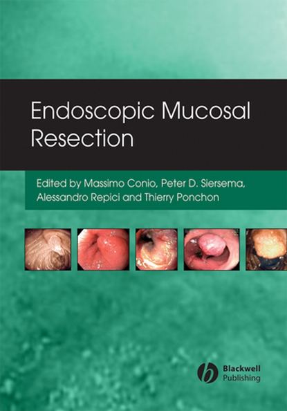 Скачать книгу Endoscopic Mucosal Resection
