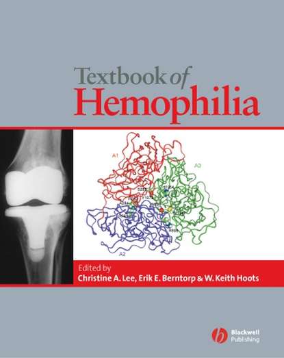 Скачать книгу Textbook of Hemophilia
