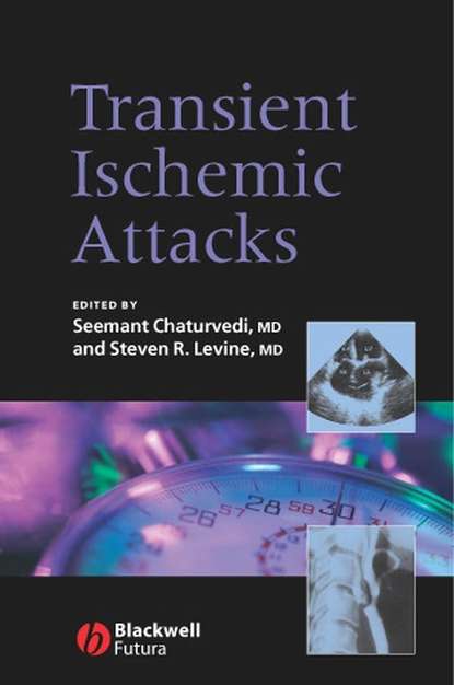 Скачать книгу Transient Ischemic Attacks