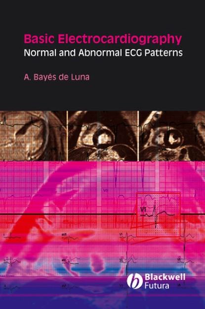 Скачать книгу Basic Electrocardiography