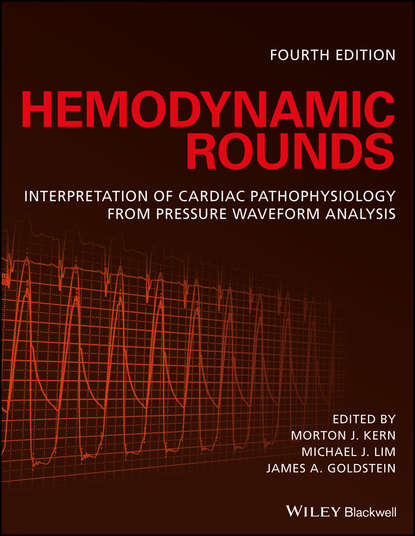 Скачать книгу Hemodynamic Rounds