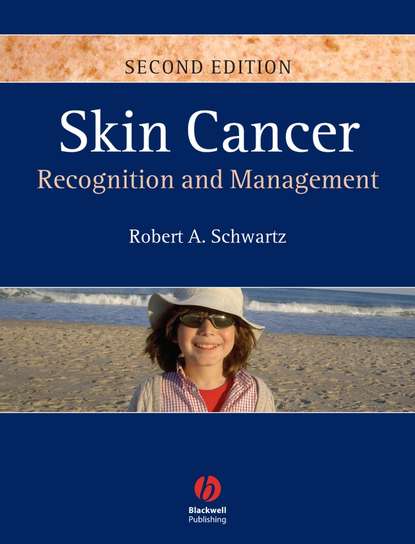 Скачать книгу Skin Cancer