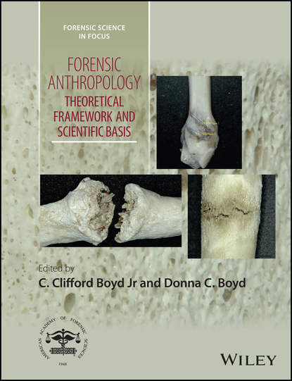 Скачать книгу Forensic Anthropology