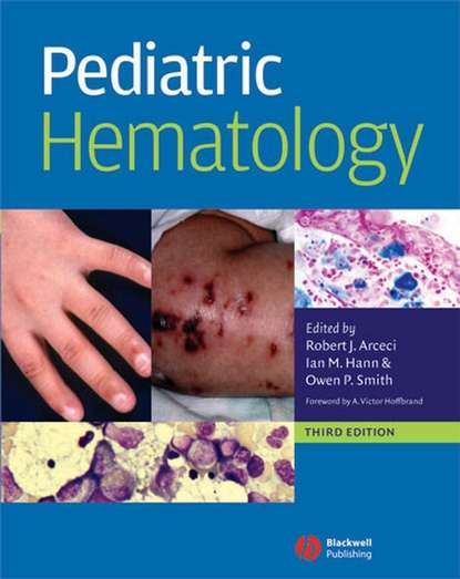 Скачать книгу Pediatric Hematology