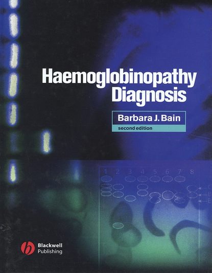 Скачать книгу Haemoglobinopathy Diagnosis