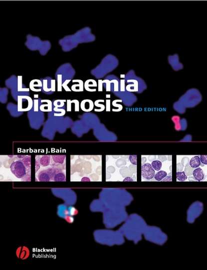 Скачать книгу Leukaemia Diagnosis