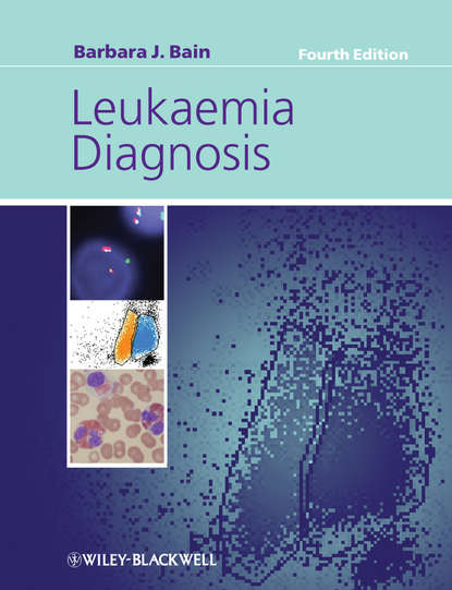 Скачать книгу Leukaemia Diagnosis