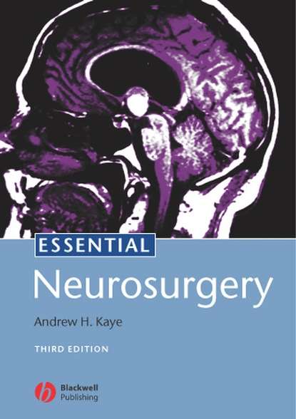 Скачать книгу Essential Neurosurgery