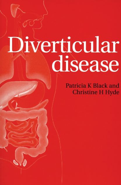 Скачать книгу Diverticular Disease