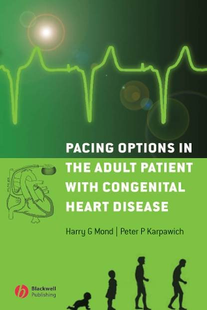 Скачать книгу Pacing Options in the Adult Patient with Congenital Heart Disease