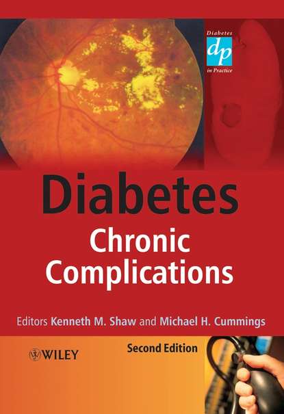Скачать книгу Diabetes