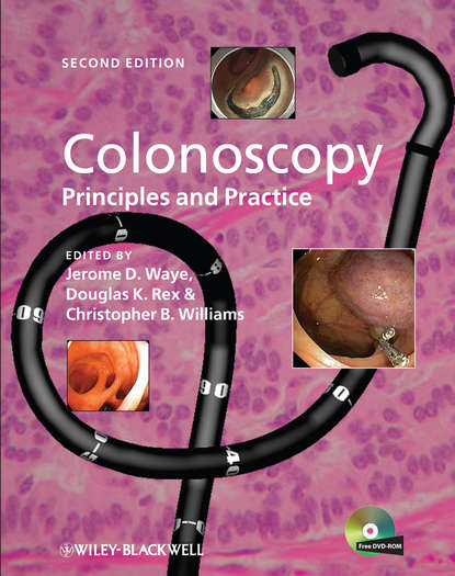 Скачать книгу Colonoscopy