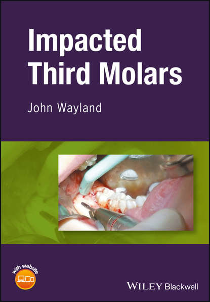 Скачать книгу Impacted Third Molars