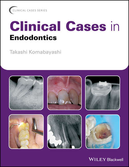Скачать книгу Clinical Cases in Endodontics