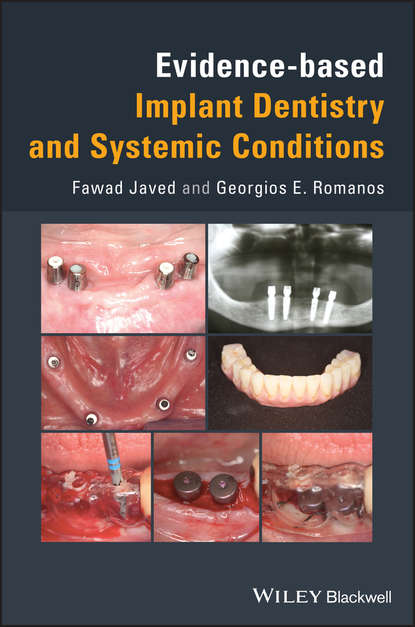 Скачать книгу Evidence-based Implant Dentistry and Systemic Conditions