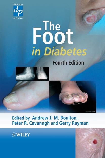 Скачать книгу The Foot in Diabetes