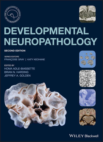Скачать книгу Developmental Neuropathology