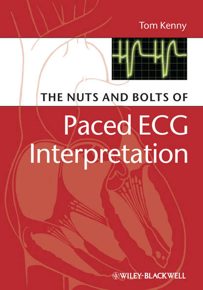 Скачать книгу The Nuts and bolts of Paced ECG Interpretation