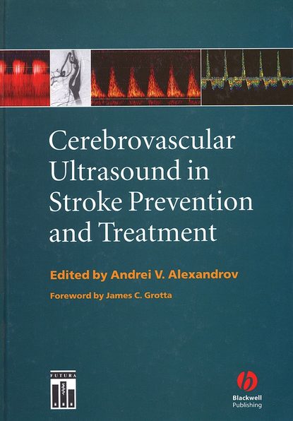 Скачать книгу Cerebrovascular Ultrasound in Stroke Prevention and Treatment