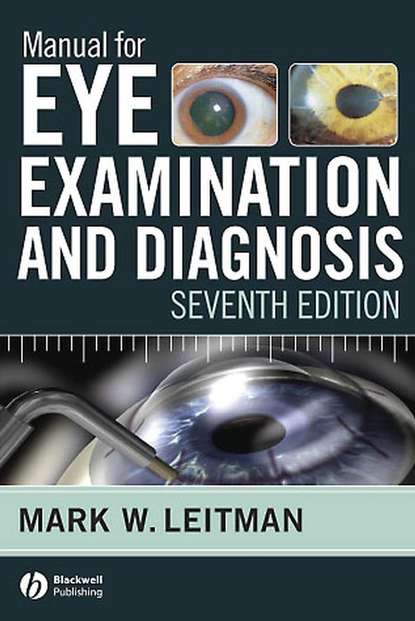 Скачать книгу Manual for Eye Examination and Diagnosis