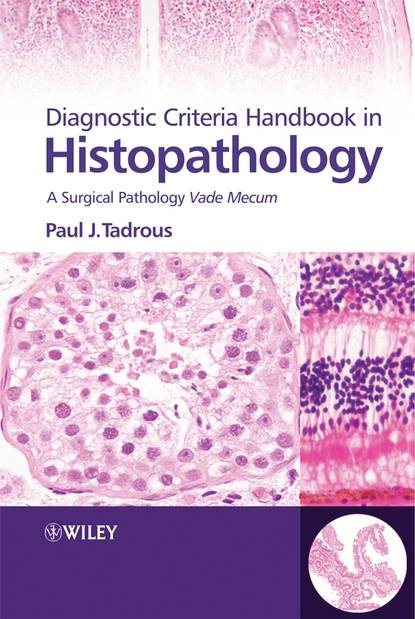 Скачать книгу Diagnostic Criteria Handbook in Histopathology