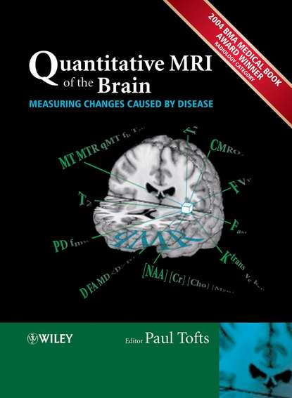 Скачать книгу Quantitative MRI of the Brain