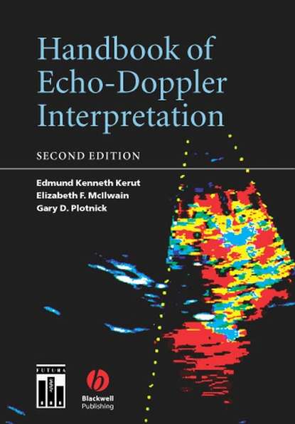 Скачать книгу Handbook of Echo-Doppler Interpretation