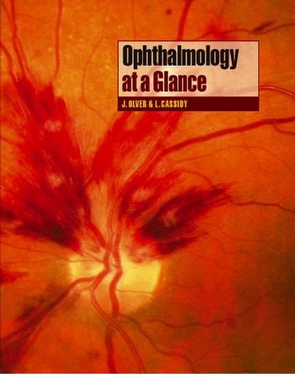 Скачать книгу Ophthalmology at a Glance