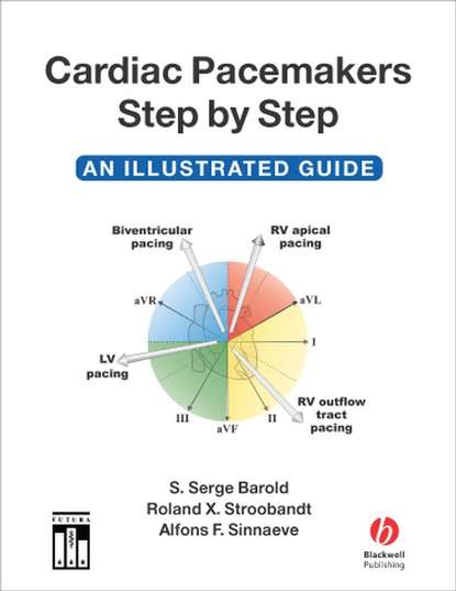 Скачать книгу Cardiac Pacemakers Step-by-Step