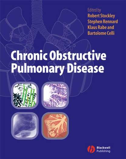 Скачать книгу Chronic Obstructive Pulmonary Disease