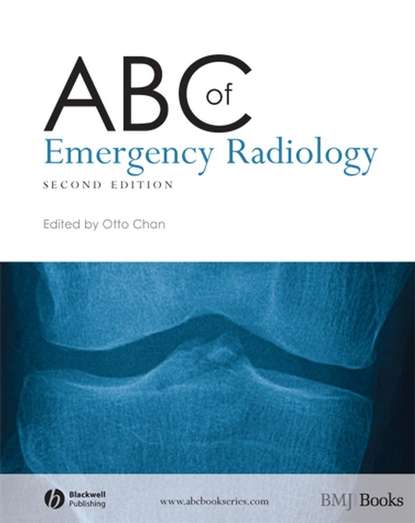 Скачать книгу ABC of Emergency Radiology