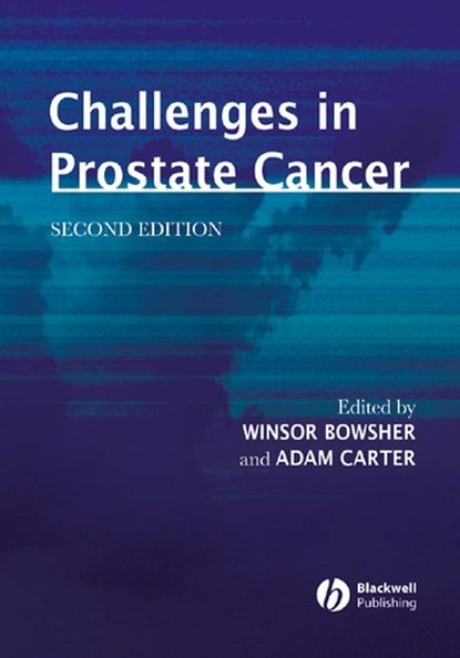 Скачать книгу Challenges in Prostate Cancer