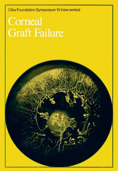 Скачать книгу Corneal Graft Failure