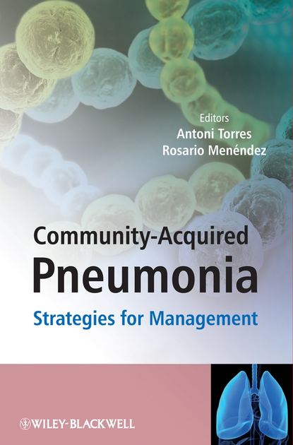 Скачать книгу Community-Acquired Pneumonia