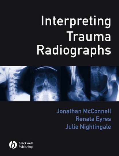 Скачать книгу Interpreting Trauma Radiographs