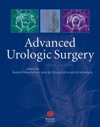 Скачать книгу Advanced Urologic Surgery