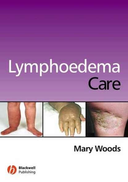 Скачать книгу Lymphoedema Care