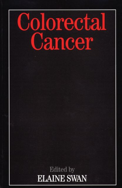 Скачать книгу Colorectal Cancer