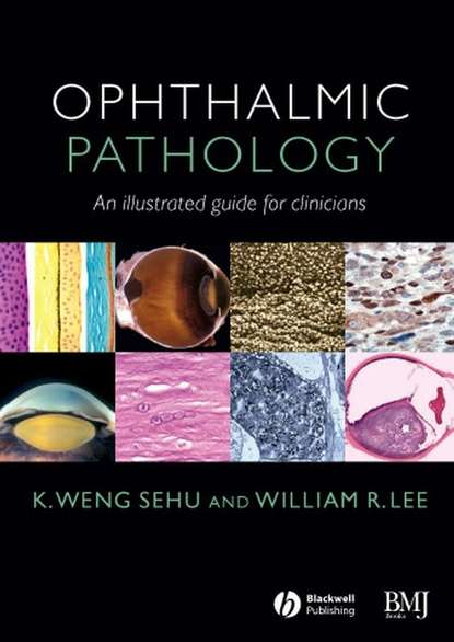 Скачать книгу Ophthalmic Pathology