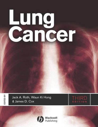 Скачать книгу Lung Cancer