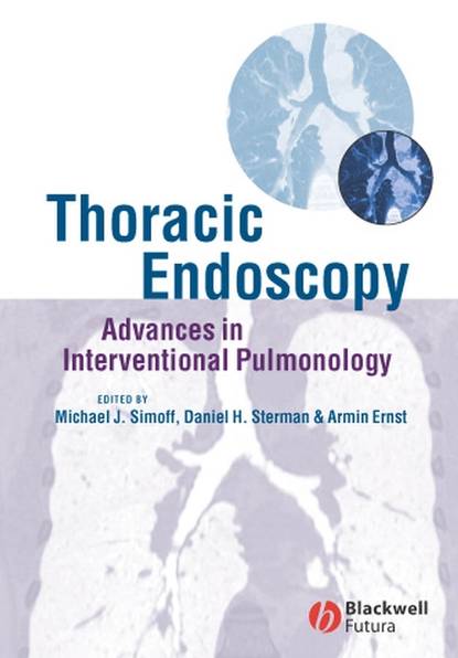 Скачать книгу Thoracic Endoscopy