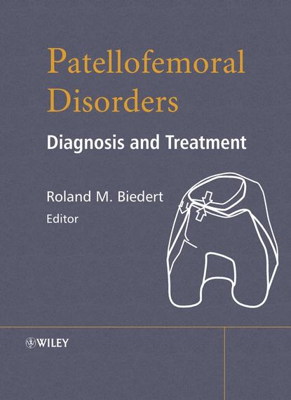 Скачать книгу Patellofemoral Disorders