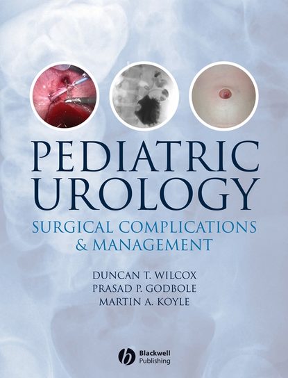 Скачать книгу Pediatric Urology