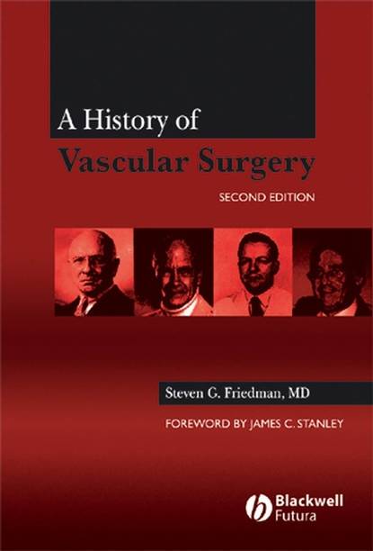 Скачать книгу A History of Vascular Surgery