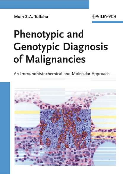Скачать книгу Phenotypic and Genotypic Diagnosis of Malignancies