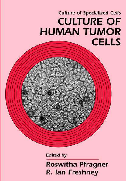 Скачать книгу Culture of Human Tumor Cells