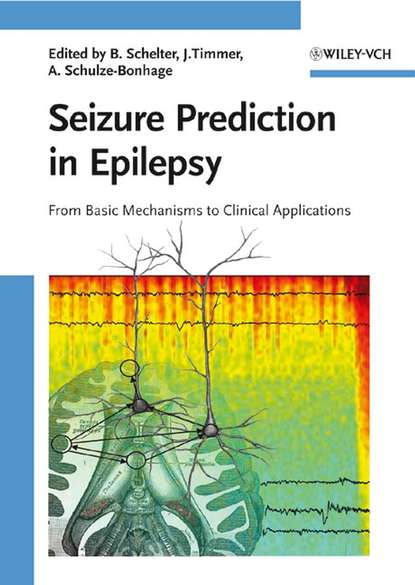 Скачать книгу Seizure Prediction in Epilepsy